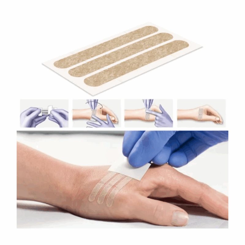 Omnistrip Tiras de Sutura Cutânea 6mm x 38mm - Image 2